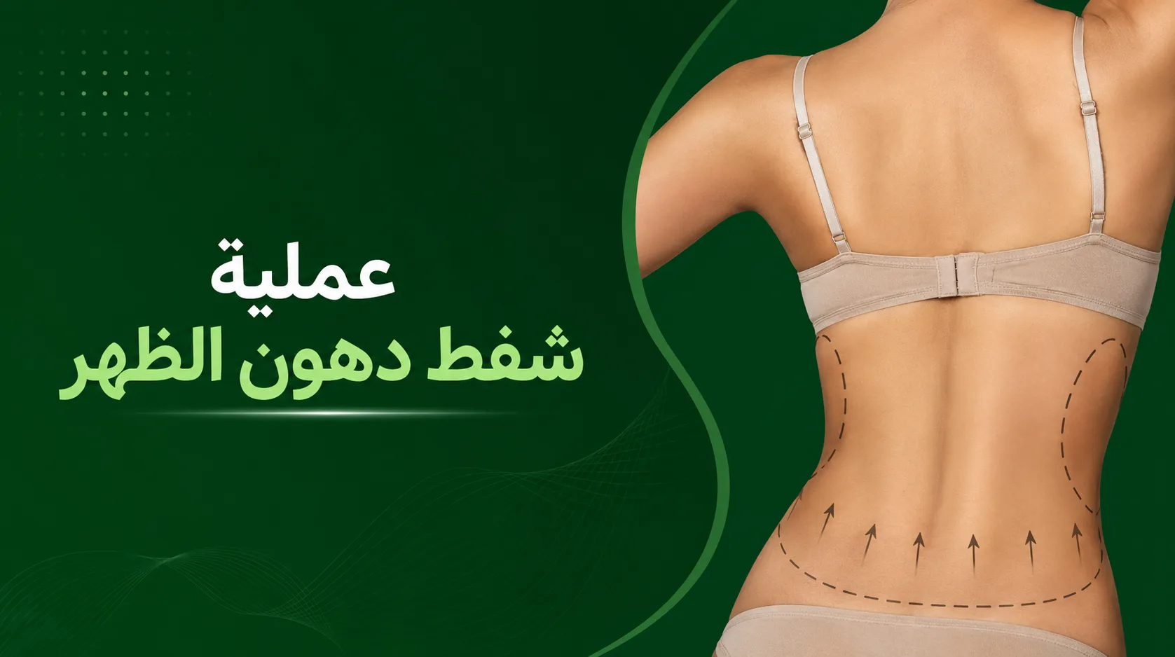 عملية شفط دهون الظهر